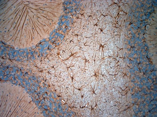 GFAP Antibody in Immunohistochemistry (Paraffin) (IHC (P))