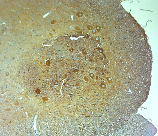 HOMER1 Antibody in Immunohistochemistry (Paraffin) (IHC (P))