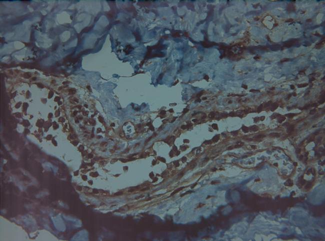 HIF1 alpha Antibody in Immunohistochemistry (Paraffin) (IHC (P))