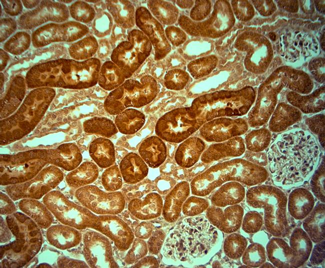 KCNJ10 Antibody in Immunohistochemistry (Paraffin) (IHC (P))