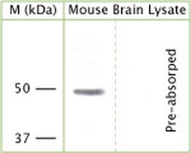 KCNJ12 Antibody in Western Blot (WB)