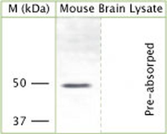 KCNJ12 Antibody in Western Blot (WB)