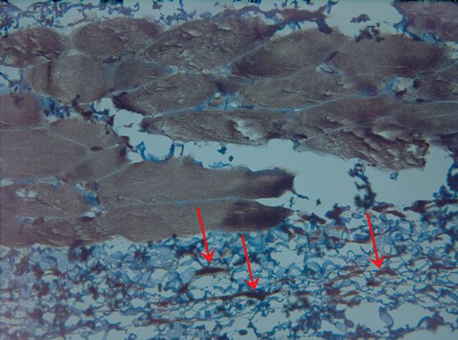 KCNN4 Antibody in Immunohistochemistry (Paraffin) (IHC (P))