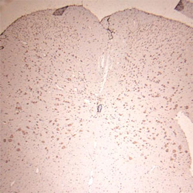 Lamp1 Antibody in Immunohistochemistry (Paraffin) (IHC (P))