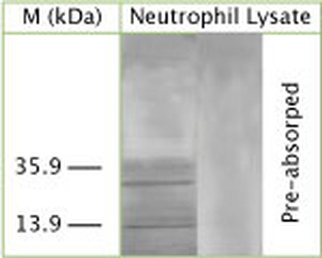 MAP1LC3A Antibody in Western Blot (WB)