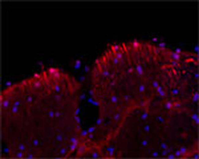 MAP2 Antibody in Immunohistochemistry (IHC)