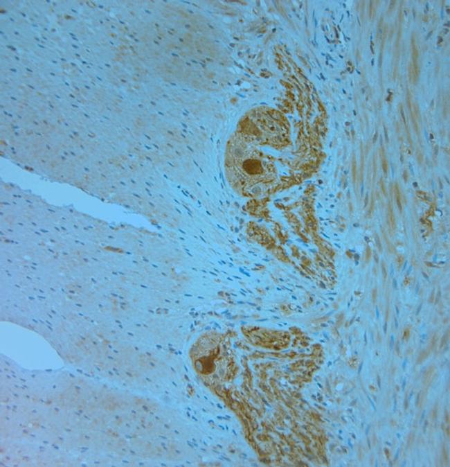 MPP1 Antibody in Immunohistochemistry (Paraffin) (IHC (P))