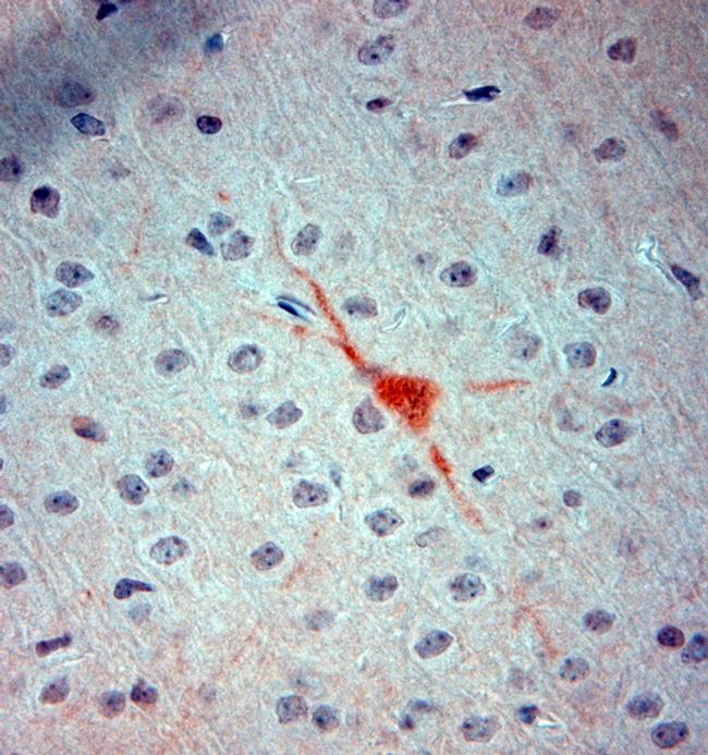 nNOS Antibody in Immunohistochemistry (Paraffin) (IHC (P))