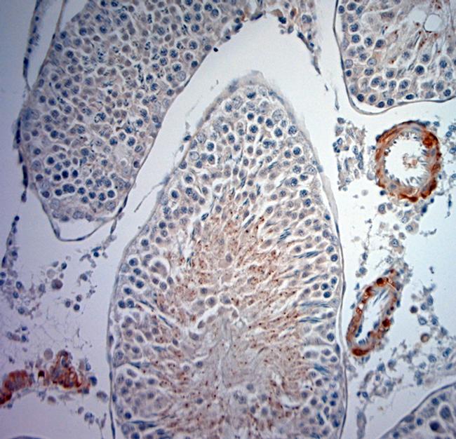 Optineurin Antibody in Immunohistochemistry (Paraffin) (IHC (P))