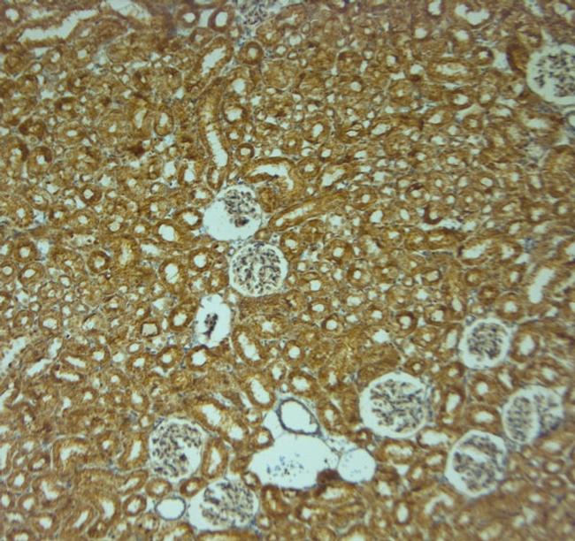 P2RY1 Antibody in Immunohistochemistry (Paraffin) (IHC (P))