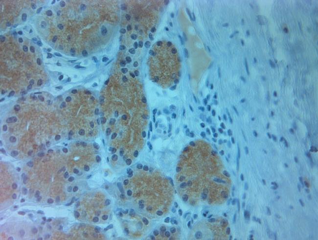 Pallidin Antibody in Immunohistochemistry (Paraffin) (IHC (P))