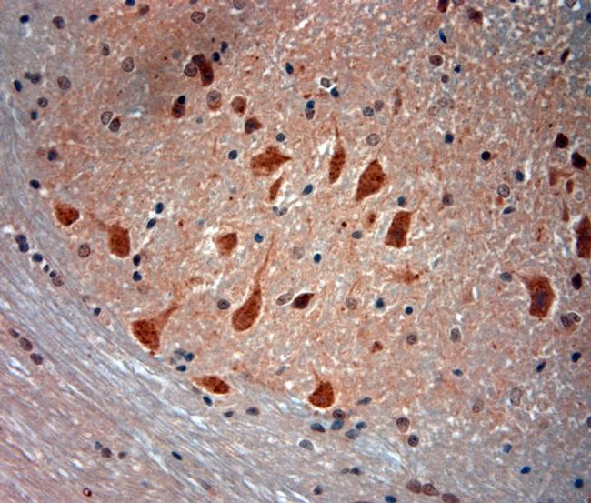 Mucolipin 1 Antibody in Immunohistochemistry (Paraffin) (IHC (P))