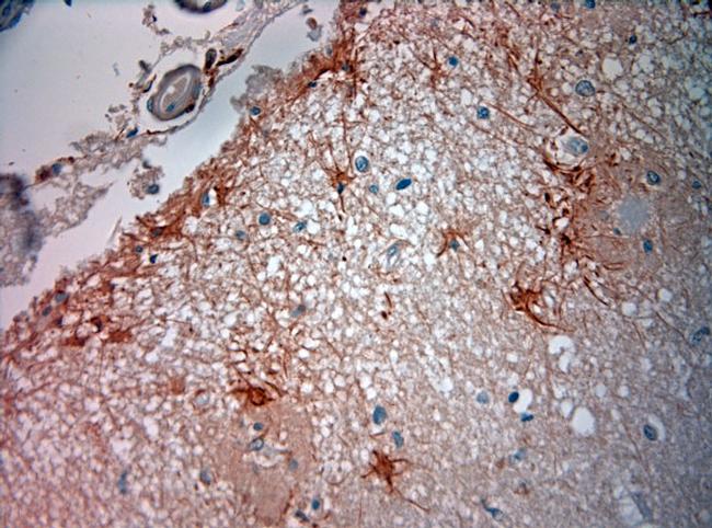 ASIC3 Antibody in Immunohistochemistry (Paraffin) (IHC (P))