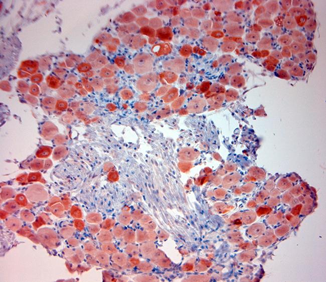 TRPV1 Antibody in Immunohistochemistry (Paraffin) (IHC (P))