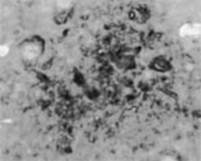 Runx3 Antibody in Immunohistochemistry (Paraffin) (IHC (P))