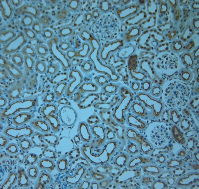 RAB6A/RAB6C Antibody in Immunohistochemistry (Paraffin) (IHC (P))