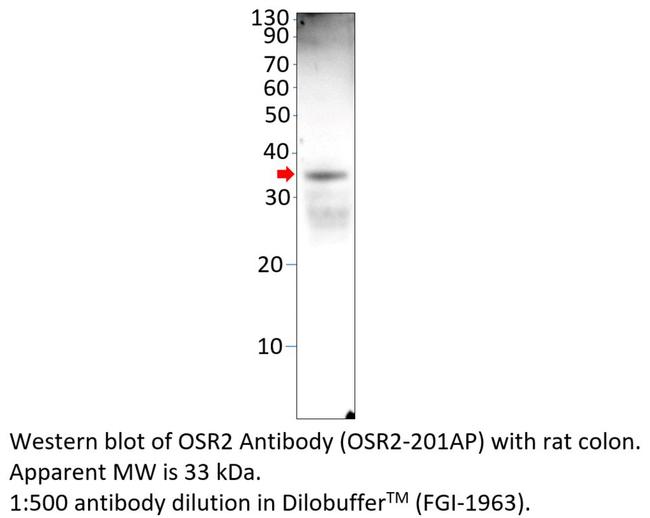 OSR2 Antibody in Western Blot (WB)