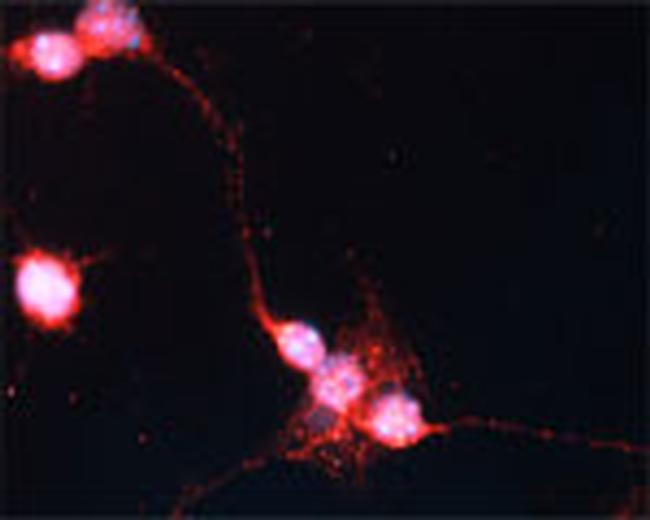 Sortilin Antibody in Immunocytochemistry (ICC/IF)