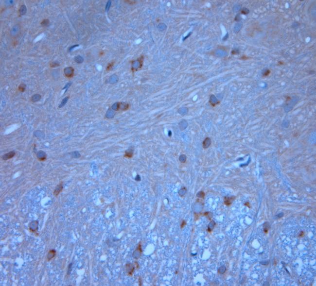 Syntaxin6 Antibody in Immunohistochemistry (Paraffin) (IHC (P))