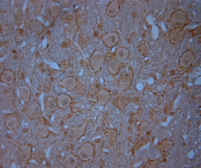 Synaptophysin Antibody in Immunohistochemistry (Paraffin) (IHC (P))