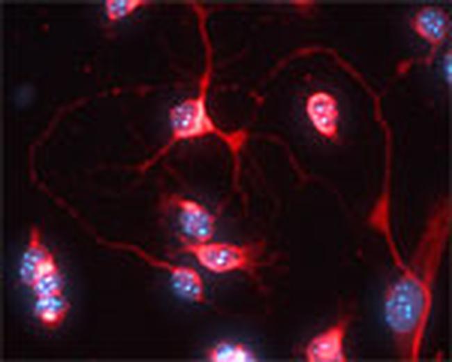 VAMP 2,1 Antibody in Immunocytochemistry (ICC/IF)