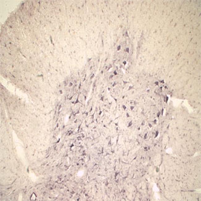 Sortilin Antibody in Immunohistochemistry (IHC)