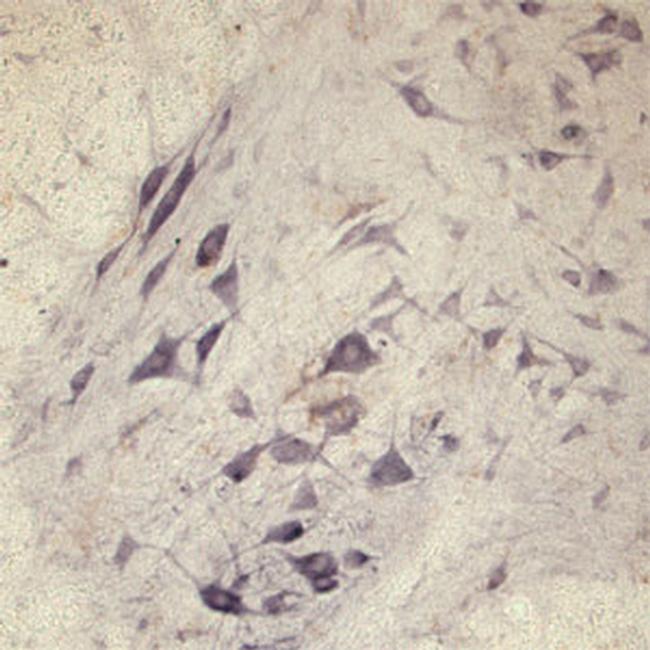 SEC22B Antibody in Immunohistochemistry (IHC)