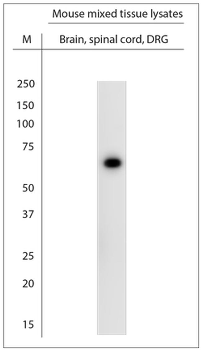 STXB1 Antibody in Western Blot (WB)