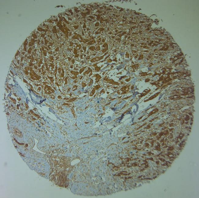 Nav1.8 Antibody in Immunohistochemistry (Paraffin) (IHC (P))