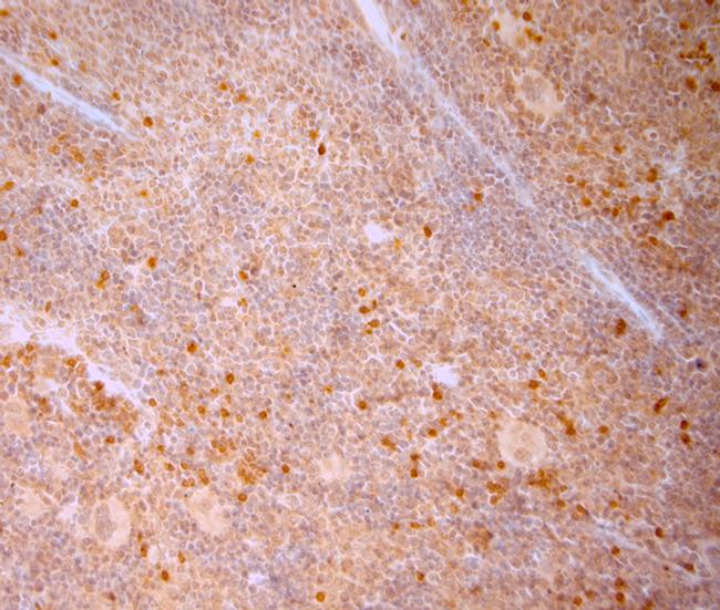 5HT1B R Antibody in Immunohistochemistry (Paraffin) (IHC (P))