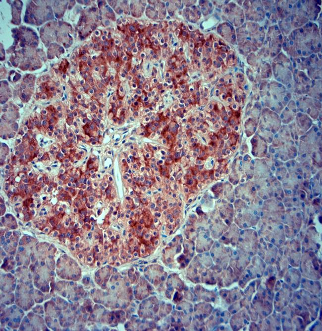 SRD5A2 Antibody in Immunohistochemistry (Paraffin) (IHC (P))