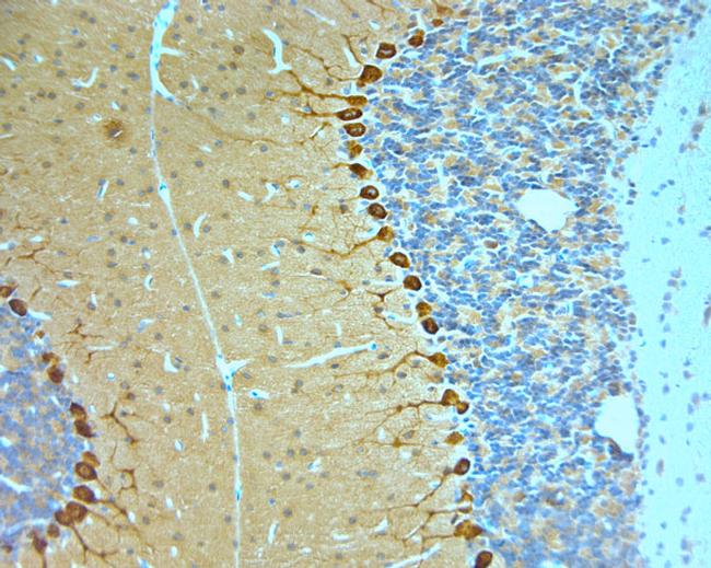 STXB1 Antibody in Immunohistochemistry (Paraffin) (IHC (P))