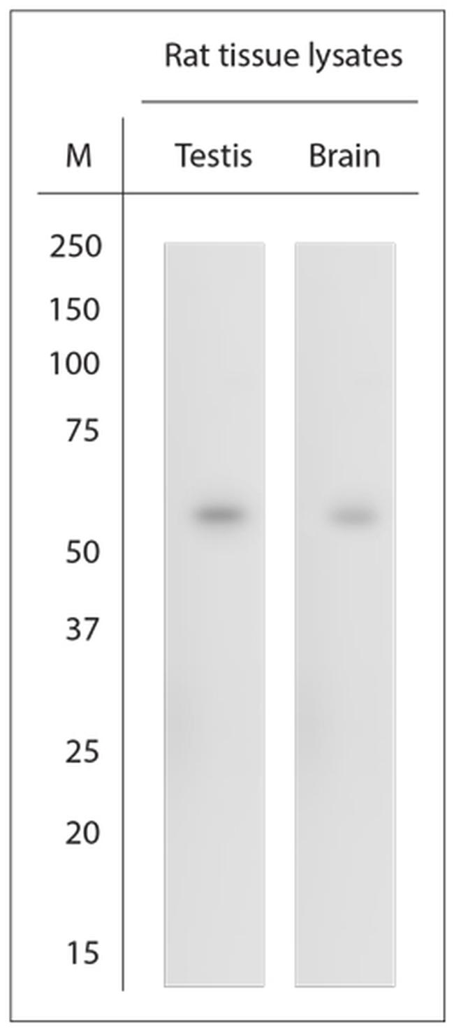 SRF Antibody in Western Blot (WB)