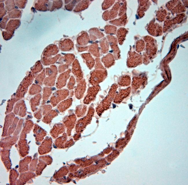 SNTB1 Antibody in Immunohistochemistry (Paraffin) (IHC (P))