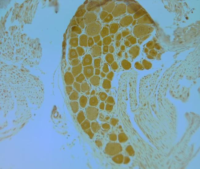 TrkB Antibody in Immunohistochemistry (Paraffin) (IHC (P))