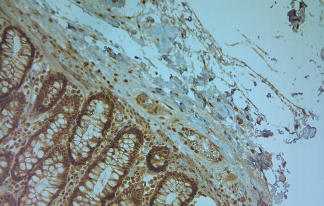 TPC1 Antibody in Immunohistochemistry (Paraffin) (IHC (P))