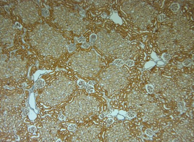 TPC1 Antibody in Immunohistochemistry (Paraffin) (IHC (P))