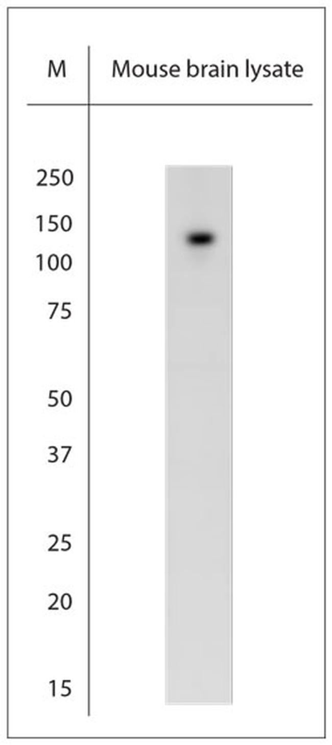 TRPC6 Antibody in Western Blot (WB)