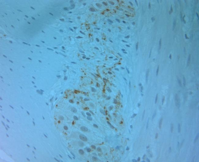 Tyrosine Hydroxylase Antibody in Immunohistochemistry (Paraffin) (IHC (P))