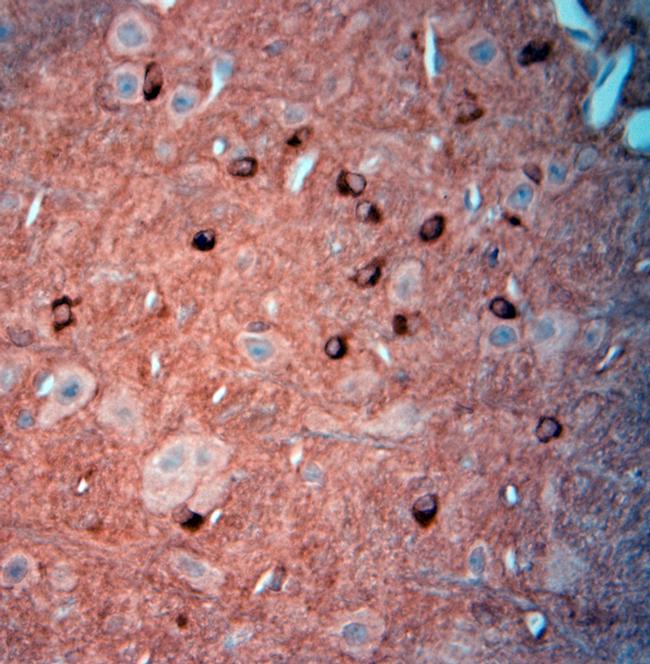 Tau Antibody in Immunohistochemistry (Paraffin) (IHC (P))