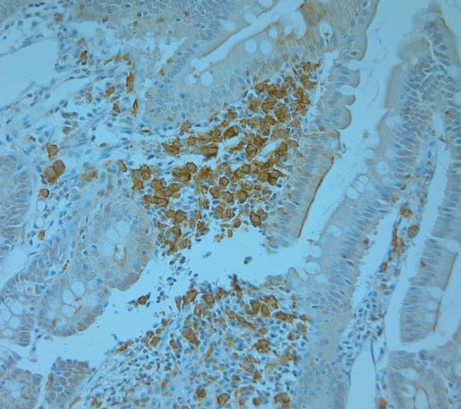 TANK Antibody in Immunohistochemistry (Paraffin) (IHC (P))