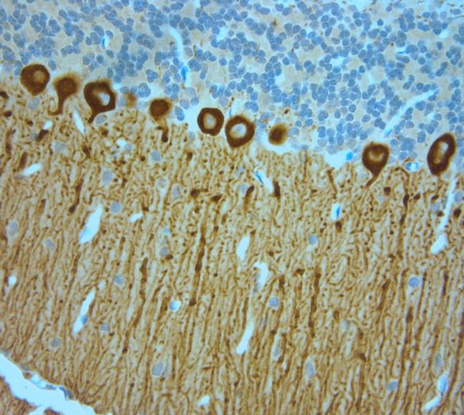 IP3R 1 Antibody in Immunohistochemistry (Paraffin) (IHC (P))