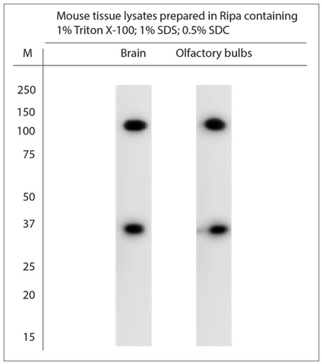 TRPC4 Antibody in Western Blot (WB)