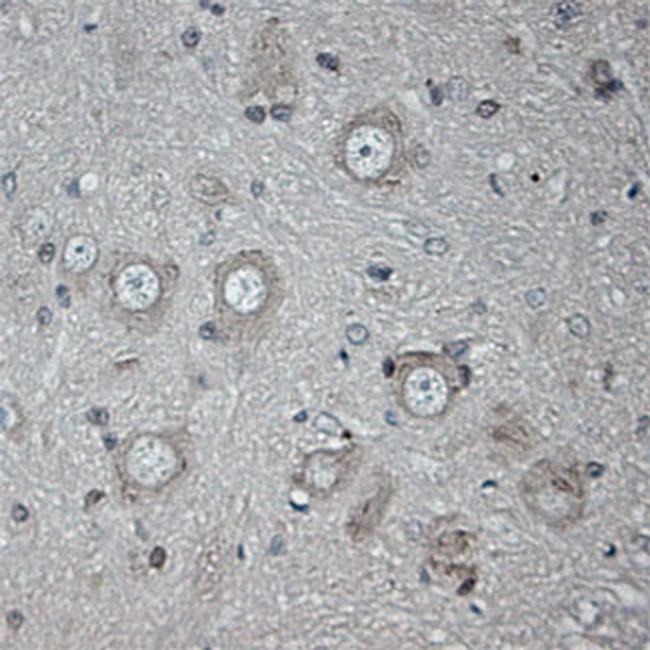 ULK1 Antibody in Immunohistochemistry (Paraffin) (IHC (P))