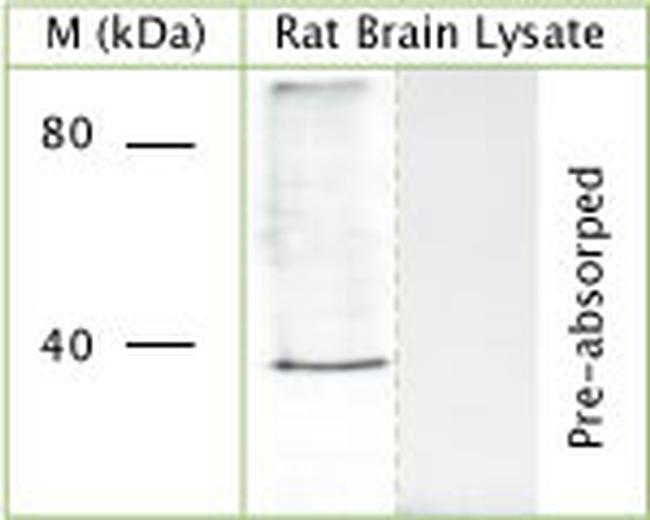 VPS26 Antibody in Western Blot (WB)