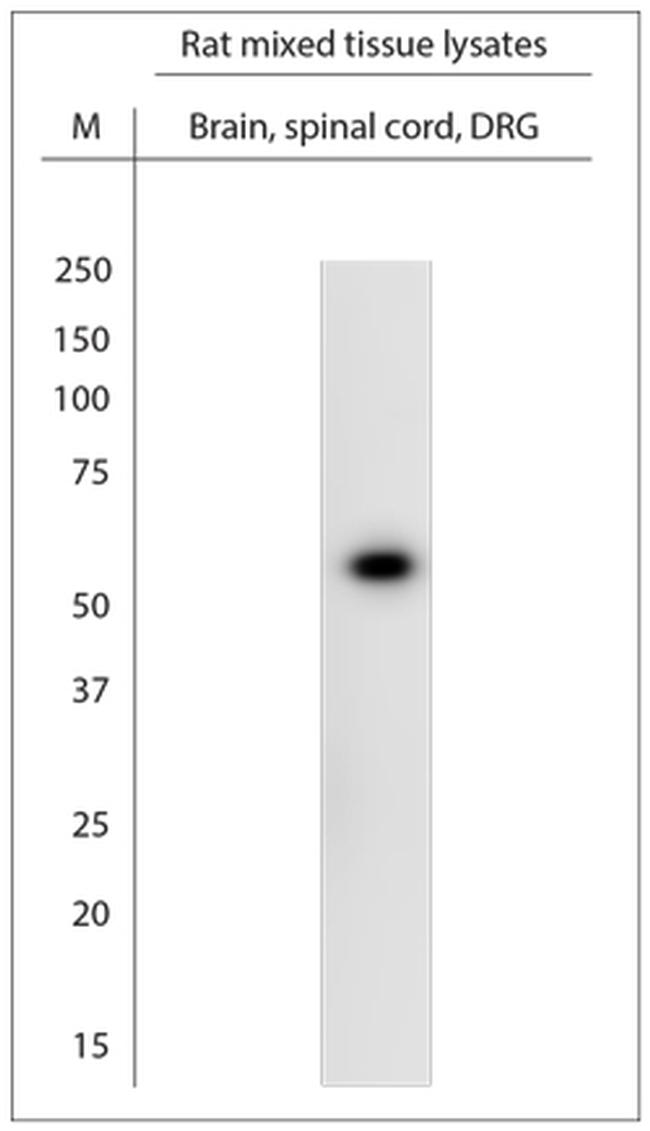 VMAT1 Antibody in Western Blot (WB)