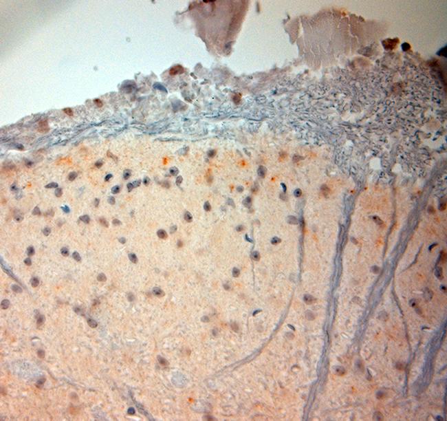 VMAT2 Antibody in Immunohistochemistry (Paraffin) (IHC (P))