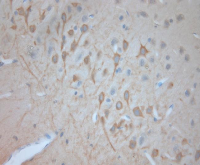 VTI1A Antibody in Immunohistochemistry (Paraffin) (IHC (P))