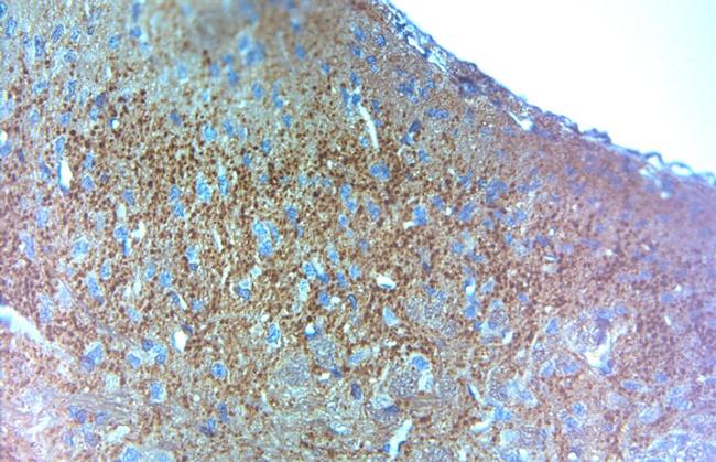 VGluT1 Antibody in Immunohistochemistry (Paraffin) (IHC (P))