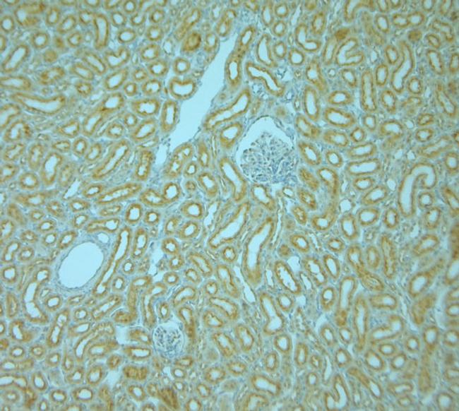 VAMP8 Antibody in Immunohistochemistry (Paraffin) (IHC (P))